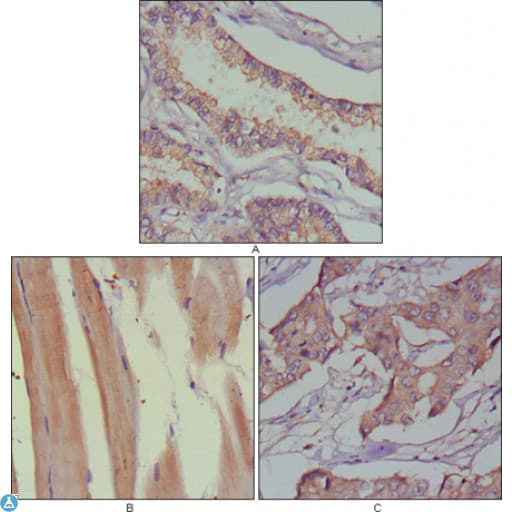 MUSK Antibody