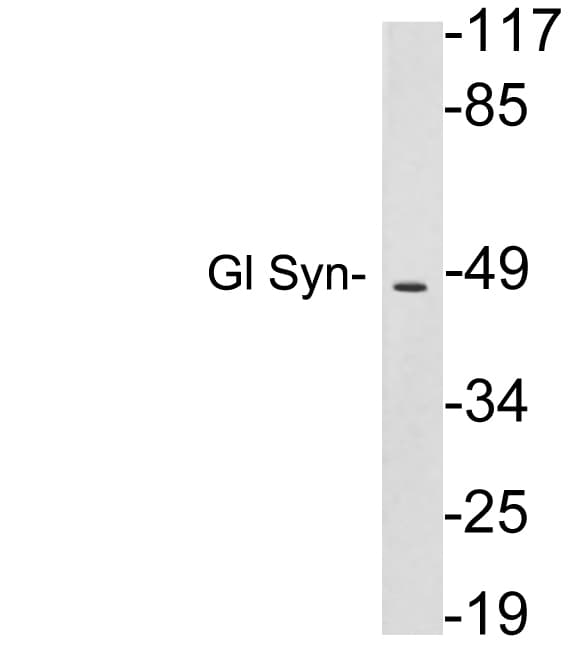GLUL / Glutamine Synthetase Antibody (aa295-344)