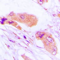 Polyclonal Rabbit anti-Human MMP1 Antibody (C-Terminus, IHC, IF, WB)