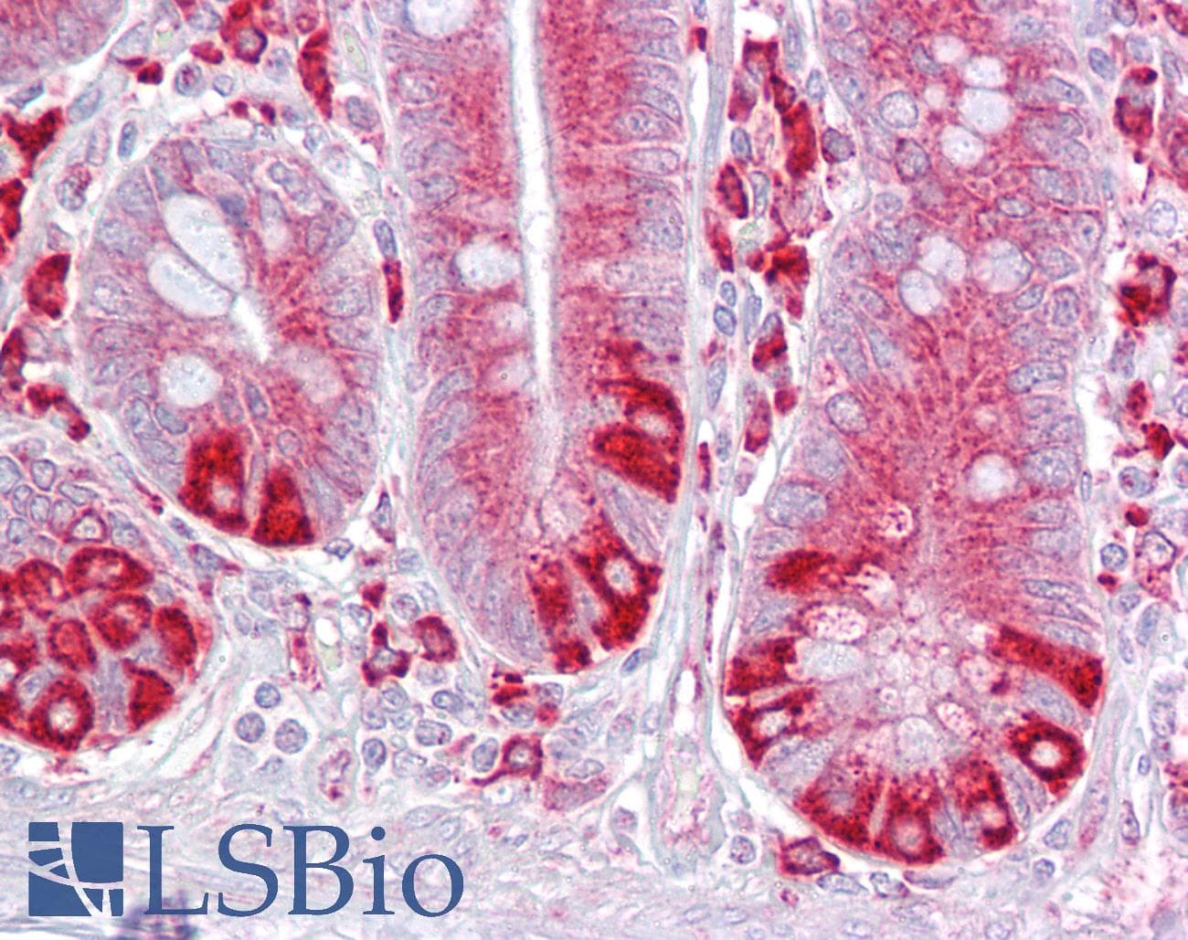 PDIA6 / ERP5 Antibody (aa216-265)