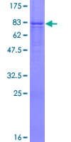Human ALG1 Protein (Recombinant GST)