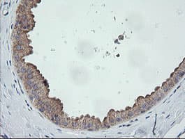 CATIP / C2orf62 Antibody (clone OTI4B4)