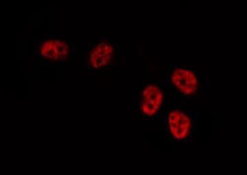 DUSP1 / MKP1 Antibody
