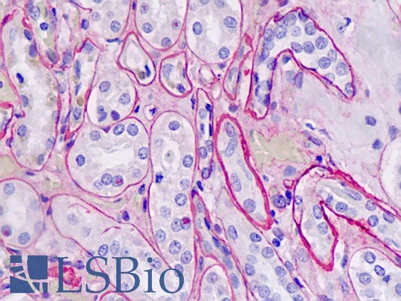 IHC-plus™ Collagen IV Antibody