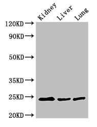 RAB5A / RAB5 Antibody