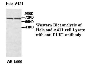 IHC-plus™ PLK1 / PLK-1 Antibody