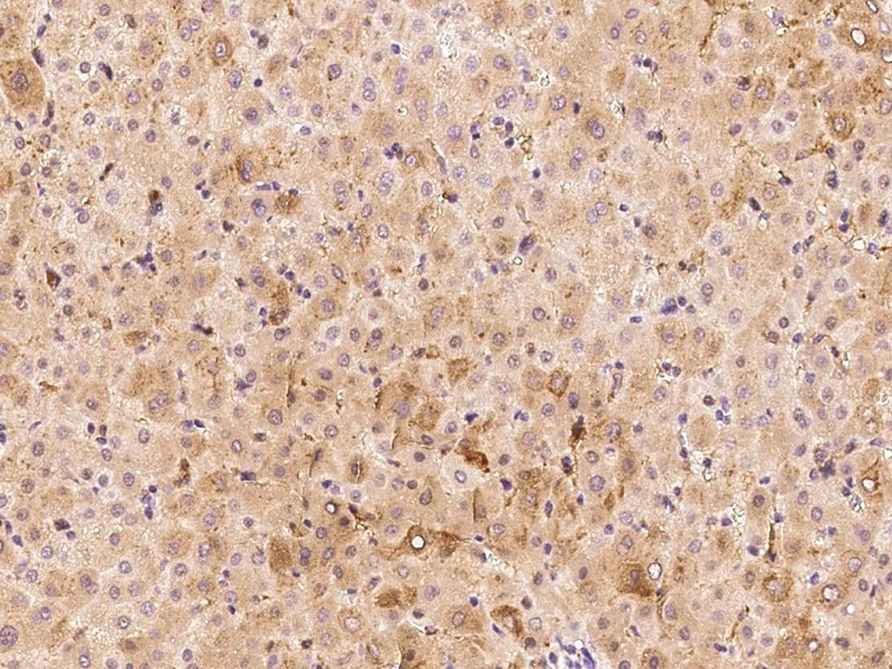 FTL / Ferritin Light Chain Antibody (Preservative Free)