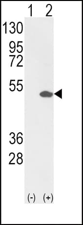PEA3 / ETV4 Antibody (aa419-447)