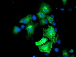 Monoclonal Mouse anti-Human MGLL / Monoacylglycerol Lipase Antibody (clone OTI1B1, IHC, IF, WB)
