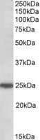 IHC-plus™ ARHGDIG / RHOGDI-3 Antibody (aa43-54)
