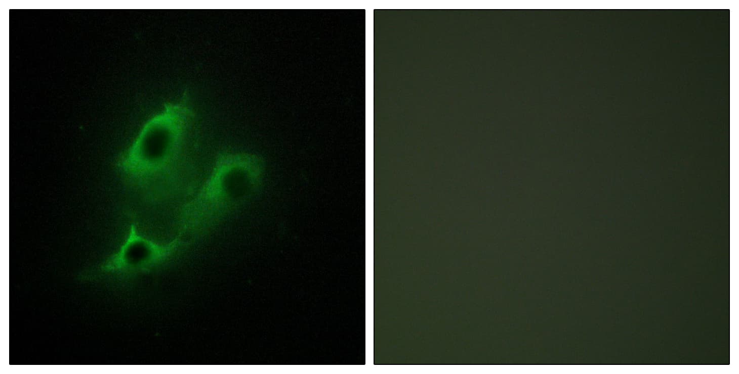 IHC-plus™ Polyclonal Rabbit anti-Human SERINC2 Antibody (aa341-390, IHC, IF, WB)
