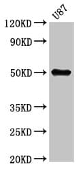 Polyclonal Rabbit anti-Human URI1 / NNX3 Antibody (IHC, WB)