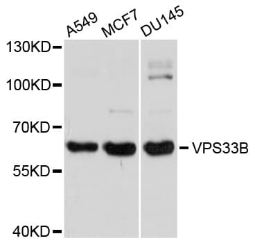 VPS33B Antibody