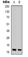 CD225 / IFITM1 Antibody (N-Terminus)