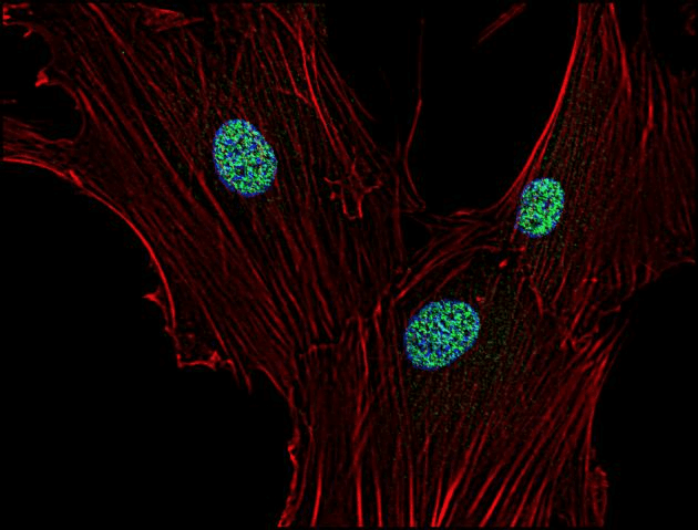 CDKN1A / WAF1 / p21 Antibody (clone WA-1)