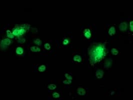 TP53 / p53 Antibody (clone OTI1C6)