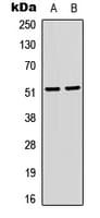 SRF / Serum Response Factor Antibody (phospho-Ser103)