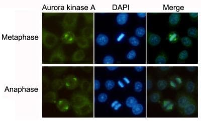 AURKA / Aurora-A Antibody