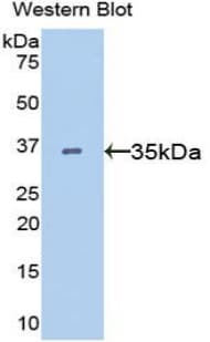 FLT4 / VEGFR3 Antibody (aa30-326)