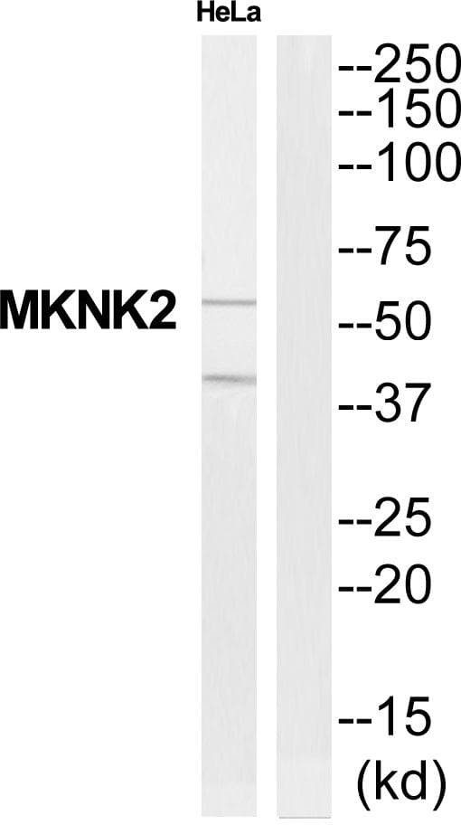 MKNK2 / MNK2 Antibody