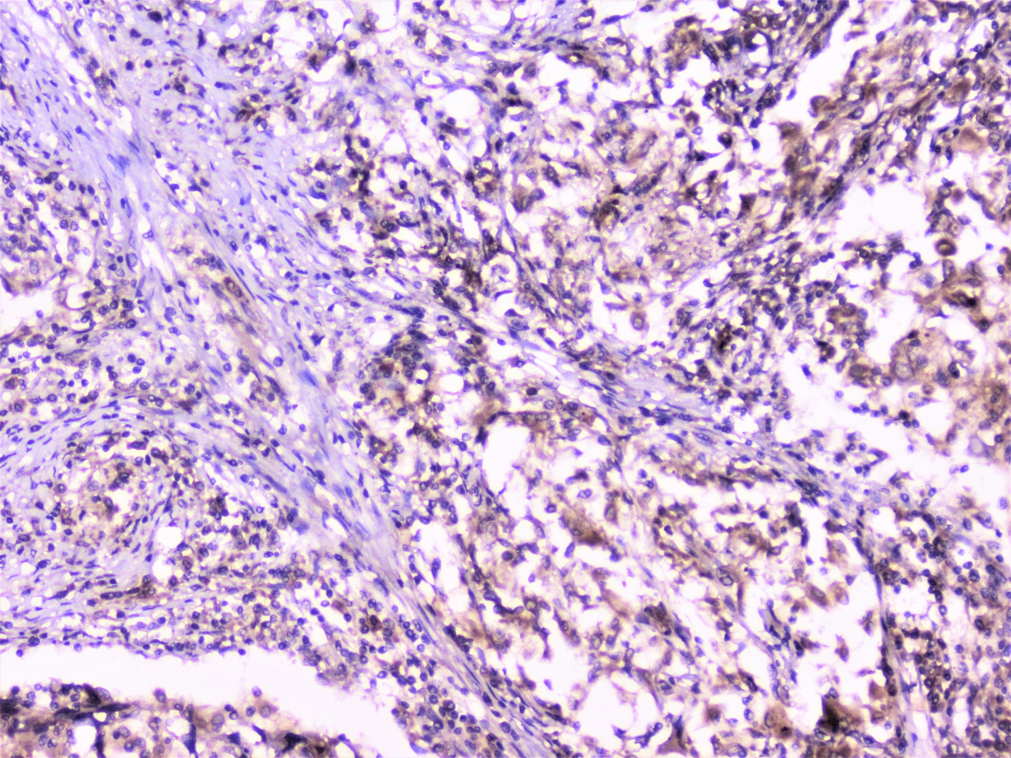 UBE2I / UBC9 Antibody