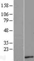 TYMSOS Protein (Over-Expression Lysate Myc-DDK (Flag))