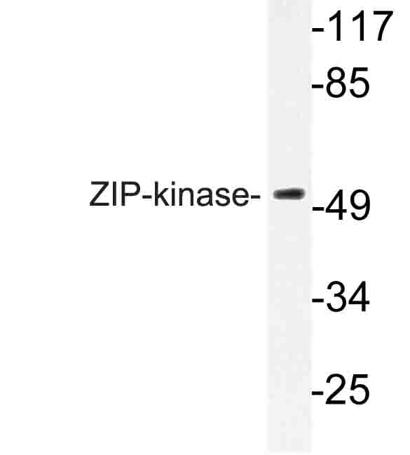 DAPK3 / ZIP Kinase Antibody (Lys261)