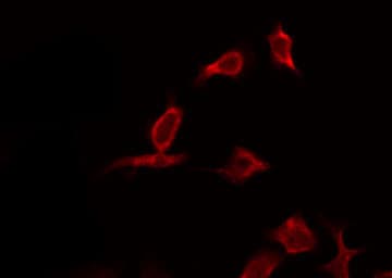 CASP9 / Caspase 9 Antibody (Cleaved Asp330)