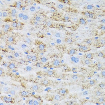 Polyclonal Rabbit anti-Human TIRAP Antibody (IHC, IF, WB)
