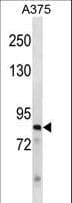 Polyclonal Rabbit anti-Human ZNF148 / ZBP-89 Antibody (aa106-135, WB)