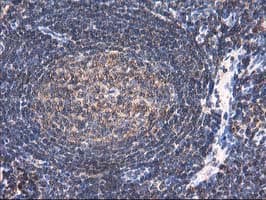 HARS2 Antibody (clone OTI3F1)