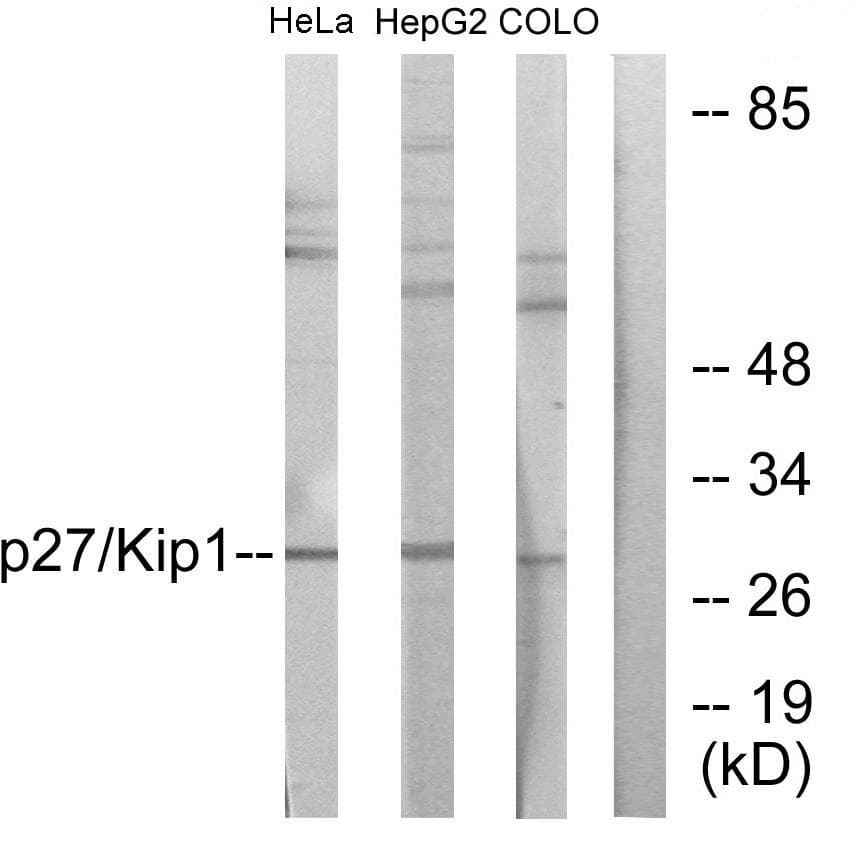 CDKN1B / p27 Kip1 Antibody (p198)