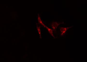 CALR / Calreticulin Antibody
