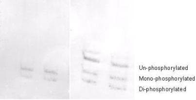 Polyclonal Rabbit anti-Human MYL12A / MRCL3 Antibody (phospho-Ser19/20, IHC, WB)