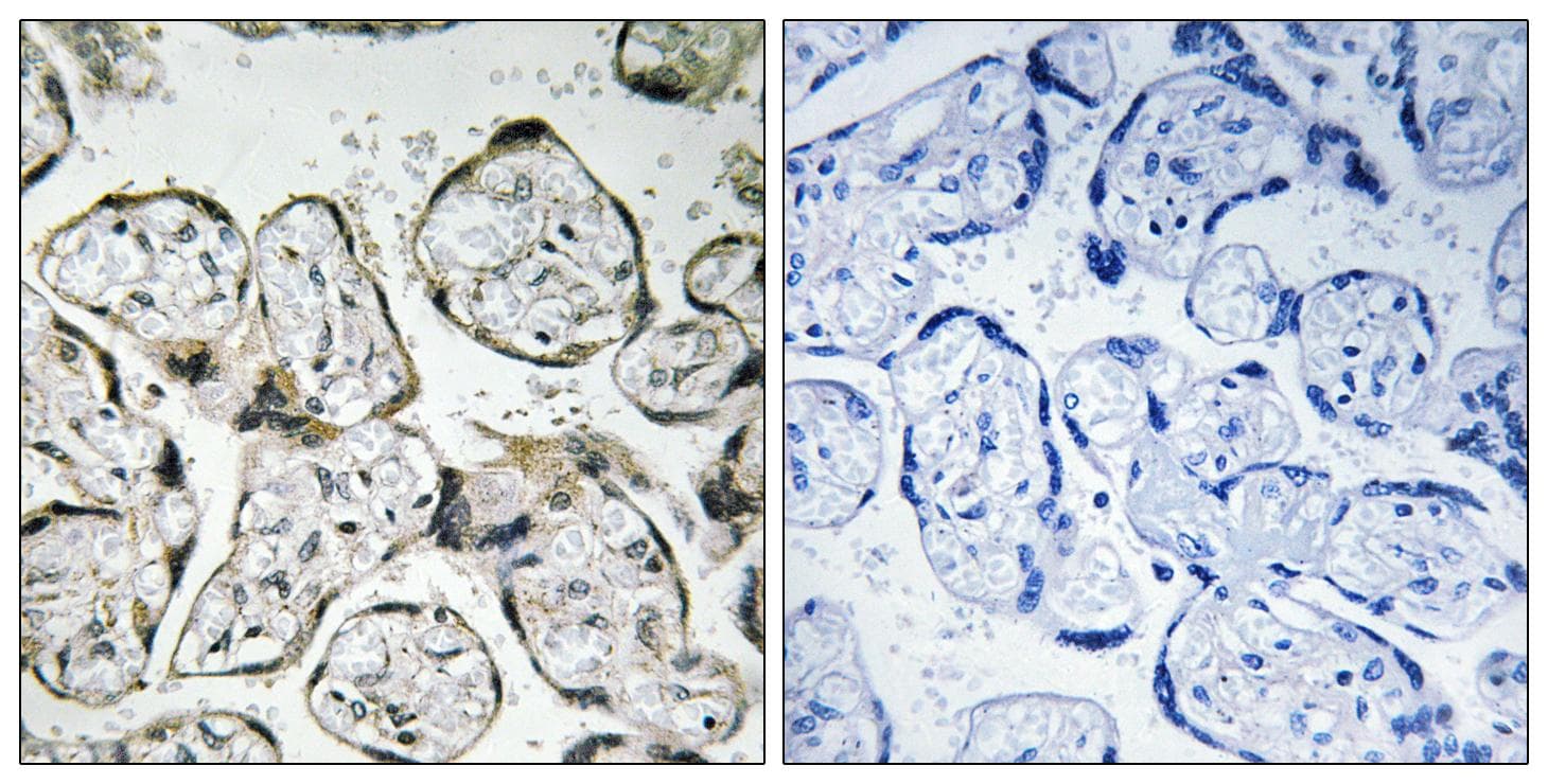 MT-ND1 Antibody
