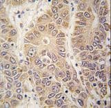 Polyclonal Rabbit anti-Human HARS Antibody (aa49-78, IHC, WB)