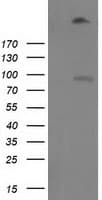 GPR49 / LGR5 Antibody (aa250-550, clone OTI1C8)