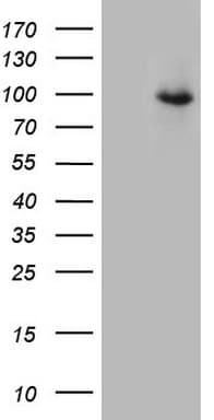 Monoclonal Mouse anti-Human TEM1 / CD248 Antibody (clone OTI1H6, aa20-300, IHC, WB)
