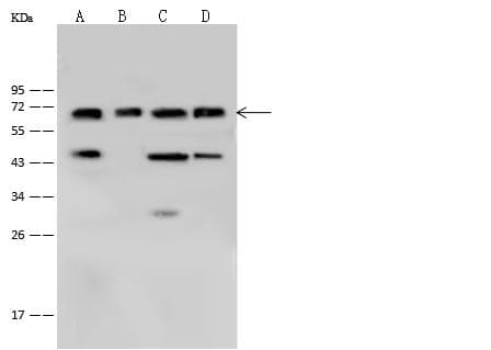 Polyclonal Rabbit anti-Human LCP1 / L-Plastin Antibody (Preservative Free, IF, WB)