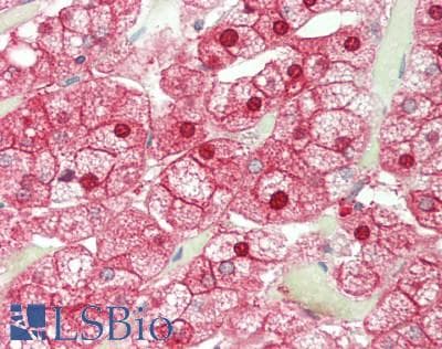 ALAD Antibody (N-Terminus)