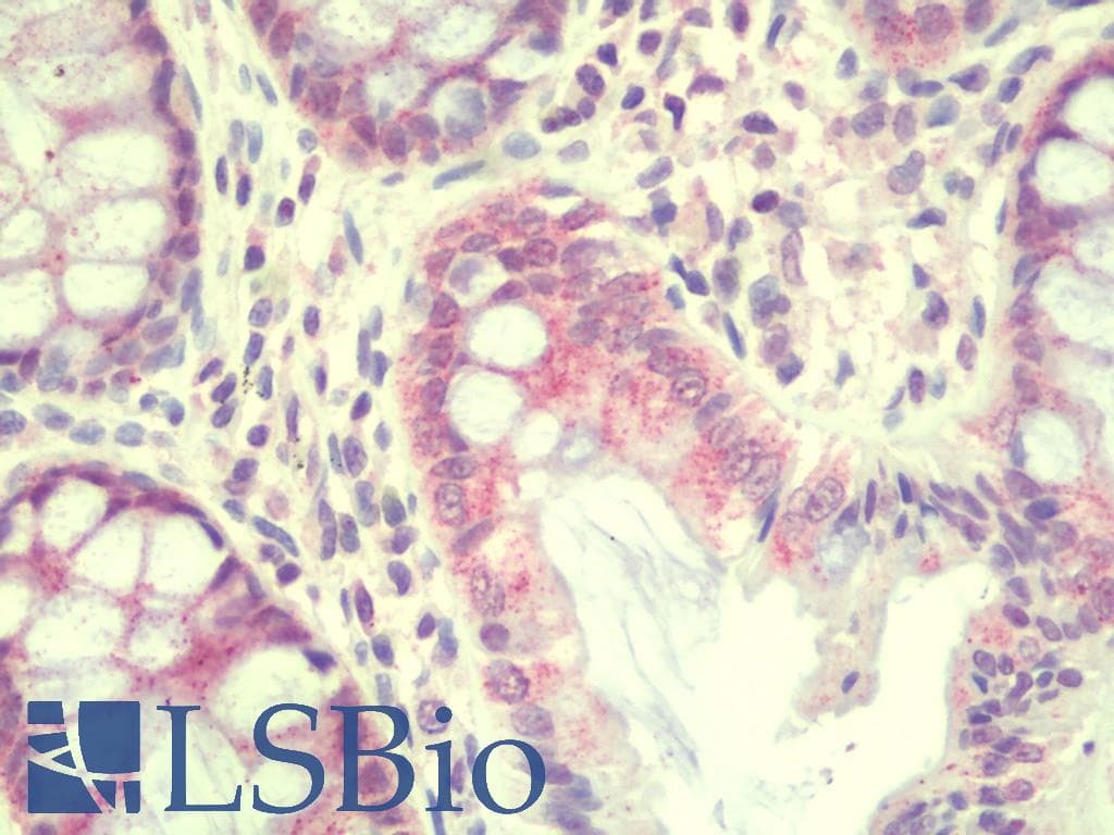 IHC-plus™ Polyclonal Rabbit anti-Human TEKT5 Antibody (IHC, WB)