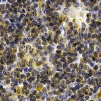Polyclonal Rabbit anti-Human SYK Antibody (IHC, IF, WB)