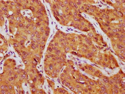 Alpha-Fetoprotein Antibody
