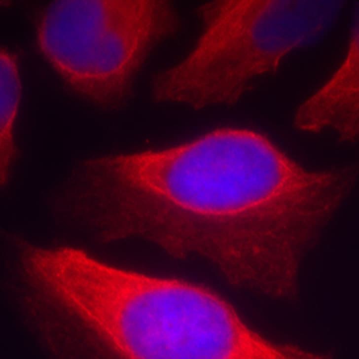 Polyclonal Rabbit anti-Human IKBKB / IKK2 / IKK Beta Antibody (phospho-Tyr199, IF)