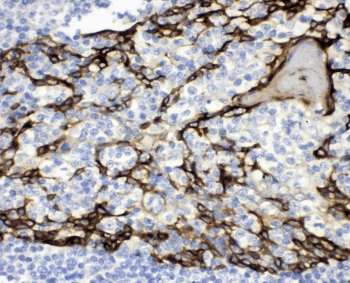 Polyclonal Rabbit anti-Human CD47 Antibody (IHC, IF, WB)