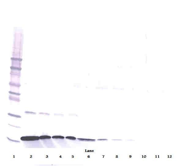 Monoclonal Mouse anti-Human IFN Gamma / Interferon Gamma Antibody (WB)