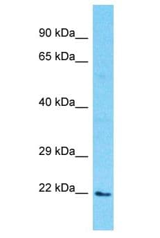PDE6D / PDE6 Delta Antibody (aa21-70)