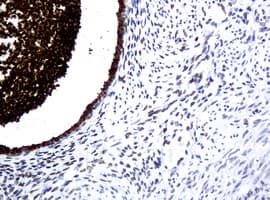 WFDC2 / HE4 Antibody (clone OTI1B9)