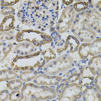 IHC-plus™ CD45 / LCA Antibody