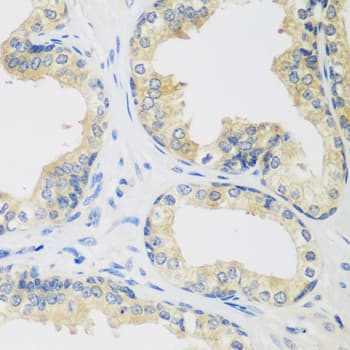 HUPF2 / UPF2 Antibody
